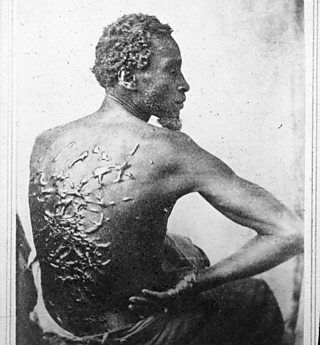 A slave with scars from being whipped