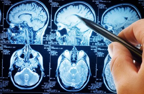 medical, brain, scan