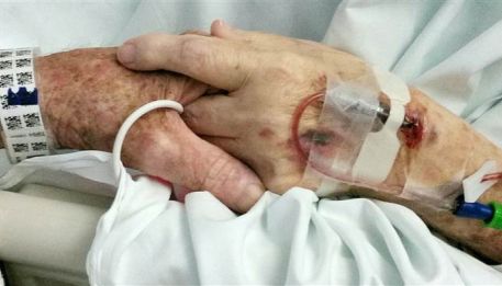 Dying couple holding hands