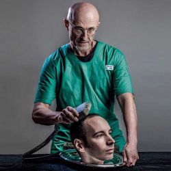 The World's First Human Head Transplant